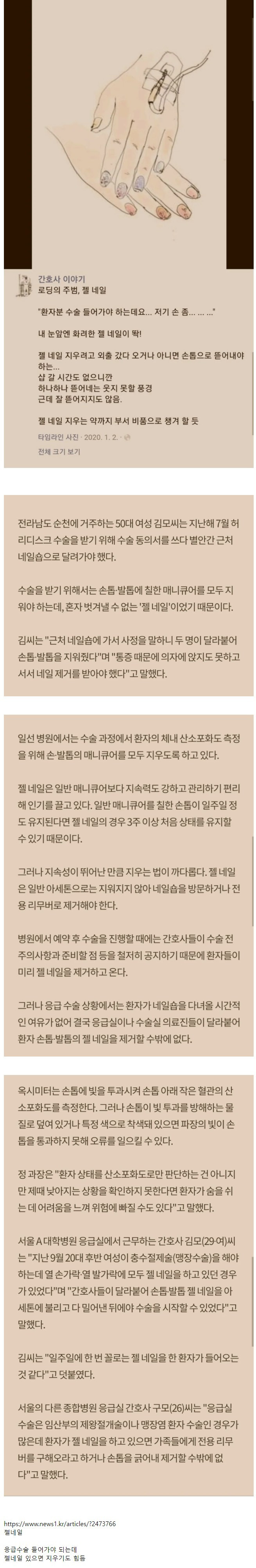 썸네일-병원에서 제일 싫어한다는 네일아트-이미지