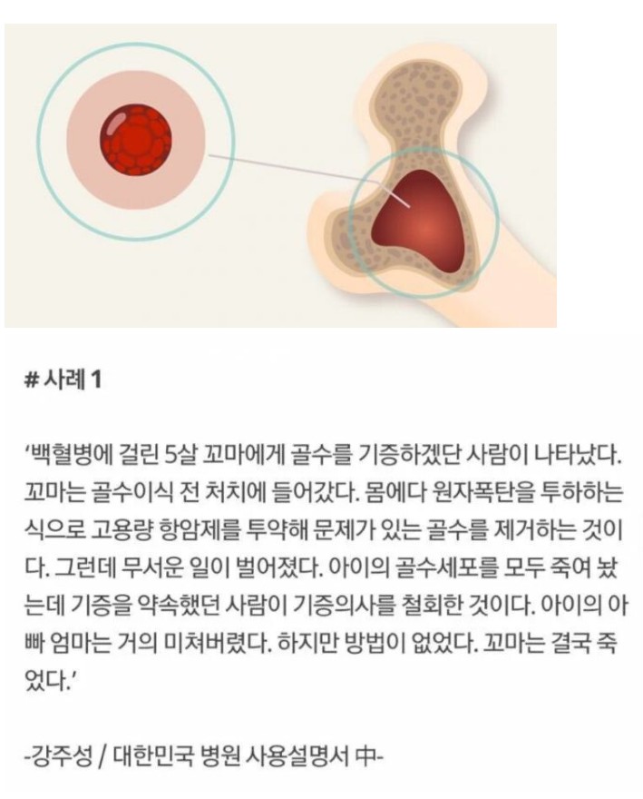 썸네일-국내 최악의 골수이식사례.jpg-이미지