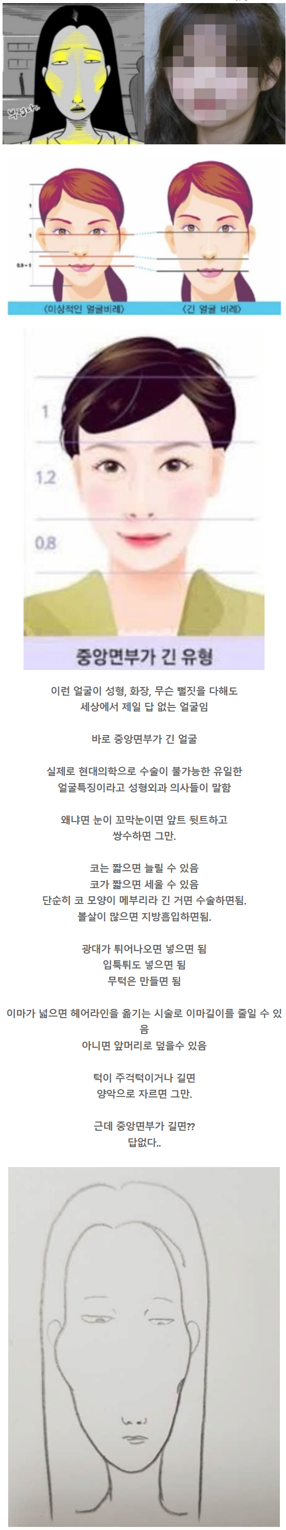 썸네일-아무리 성형해도 예뻐질 수 없는 얼굴 특-이미지