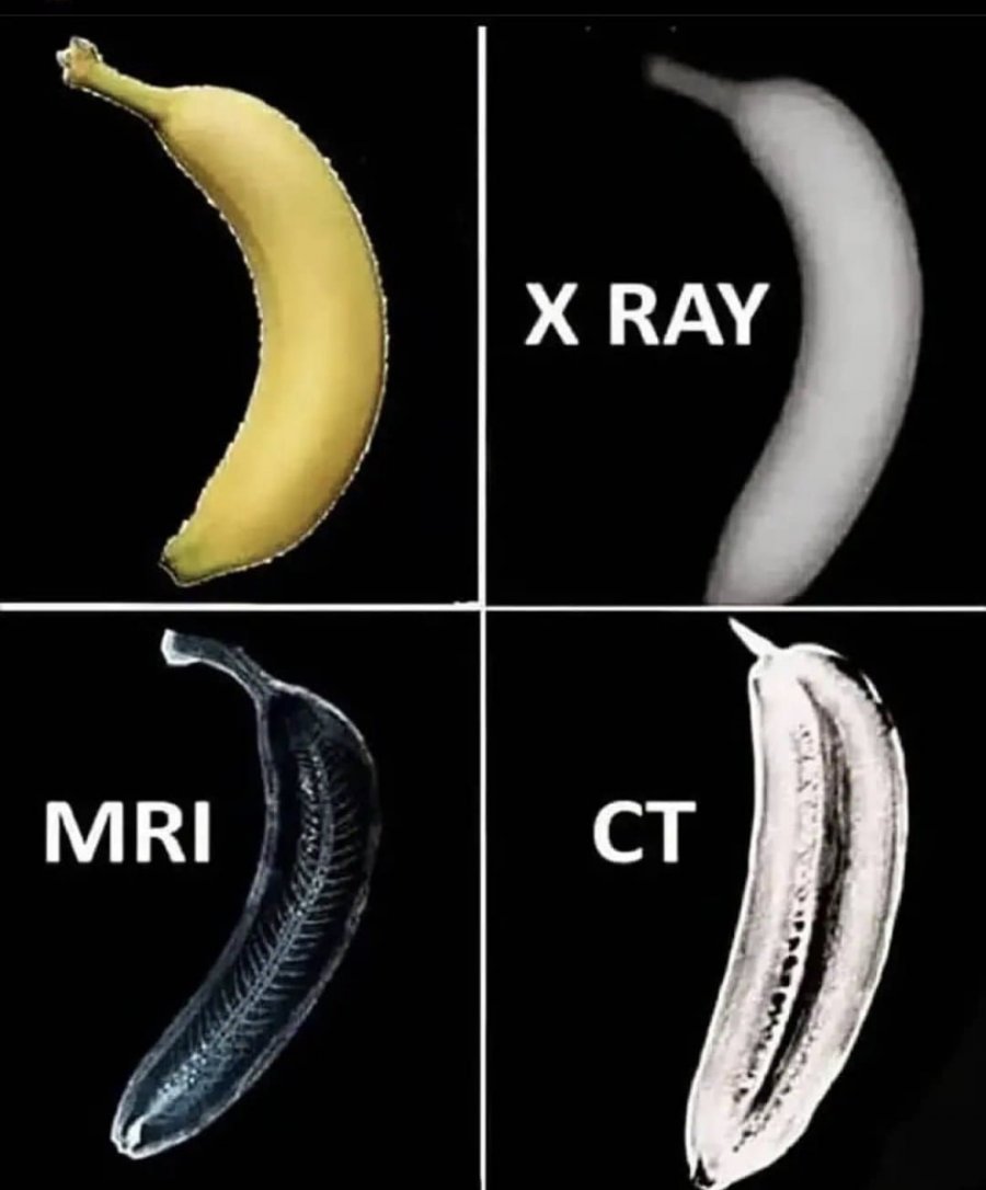 nokbeon.net-바나나로 보는 엑스레이, CT, MRI 차이점-1번 이미지