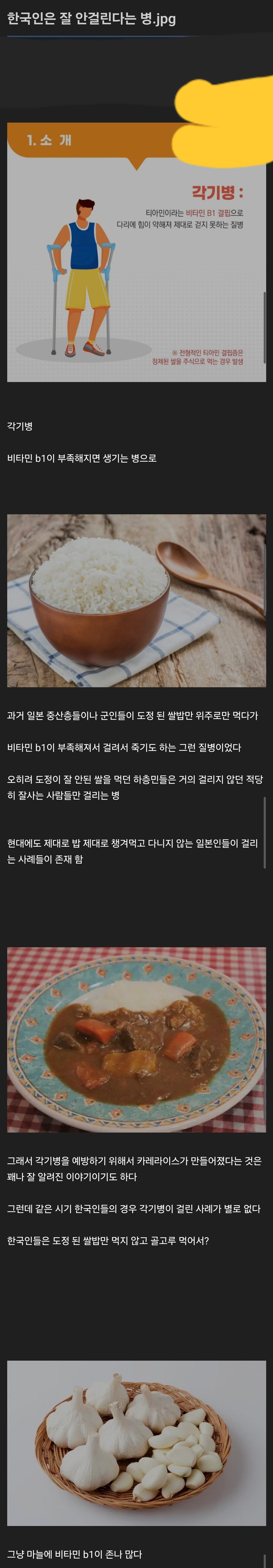 nokbeon.net-한국인은 잘 안걸리는 병-1번 이미지